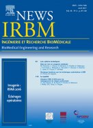 IRBM